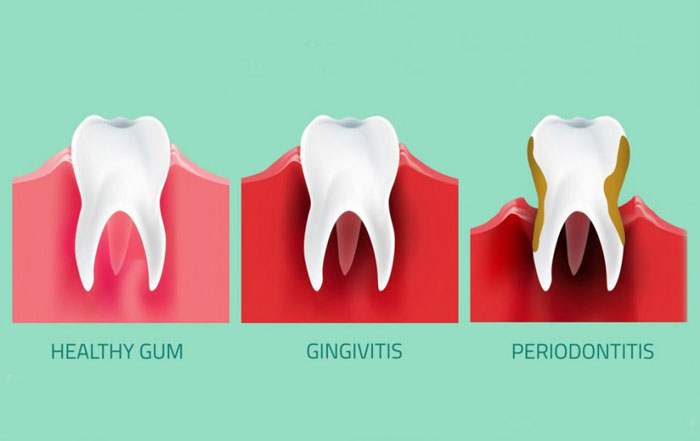 tooth chart